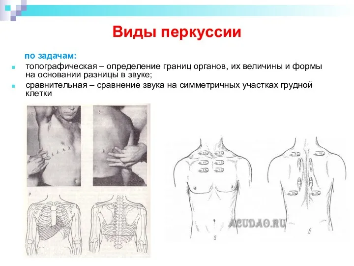 Виды перкуссии по задачам: топографическая – определение границ органов, их величины и