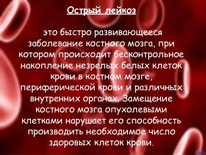 Острый лейкоз это быстро развивающееся заболевание костного мозга, при котором происходит бесконтрольное