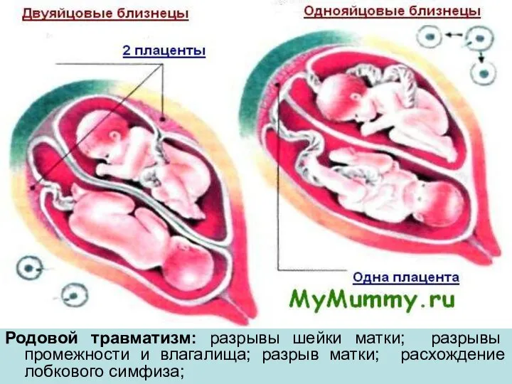 Родовой травматизм: разрывы шейки матки; разрывы промежности и влагалища; разрыв матки; расхождение лобкового симфиза;