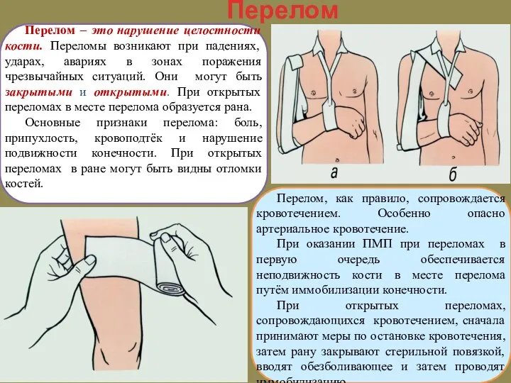 Перелом Перелом – это нарушение целостности кости. Переломы возникают при падениях, ударах,