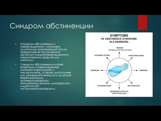 Синдром абстиненции Синдром абстиненции у новорожденного - комплекс симптомов, возникающий после прекращения