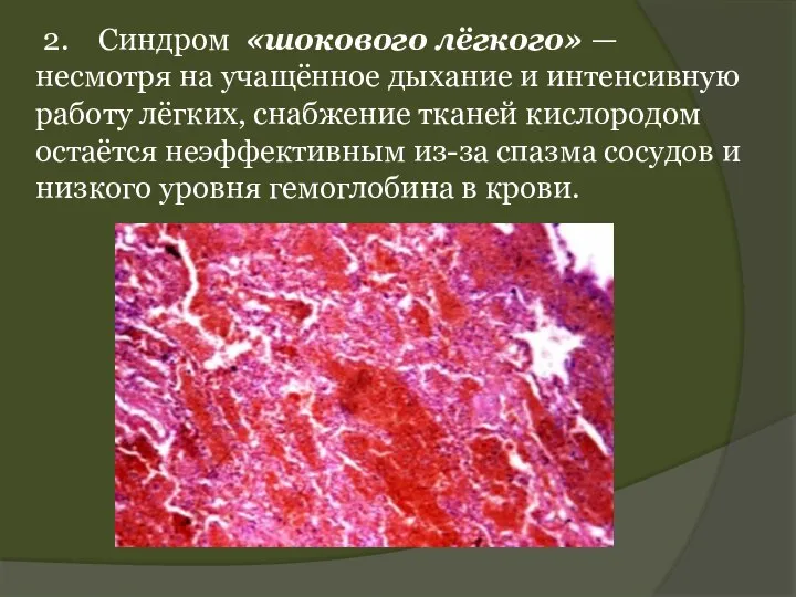 2. Синдром «шокового лёгкого» — несмотря на учащённое дыхание и интенсивную работу