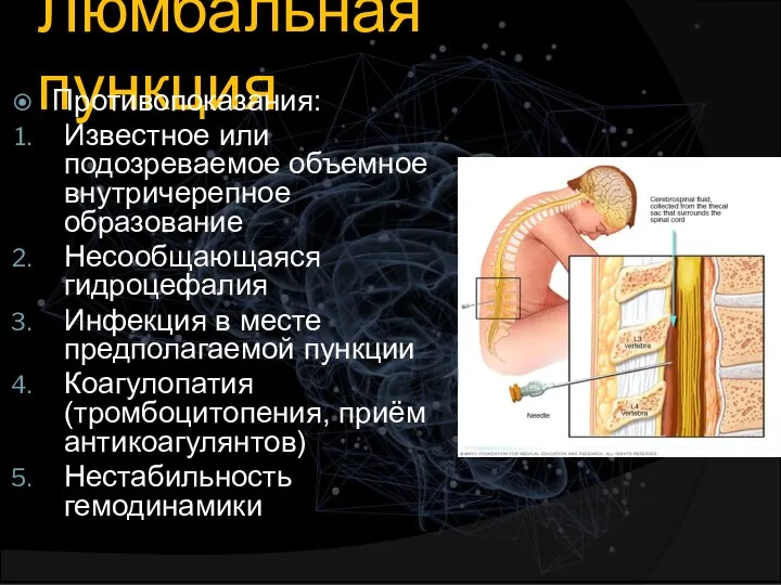 Люмбальная пункция Противопоказания: Известное или подозреваемое объемное внутричерепное образование Несообщающаяся гидроцефалия Инфекция