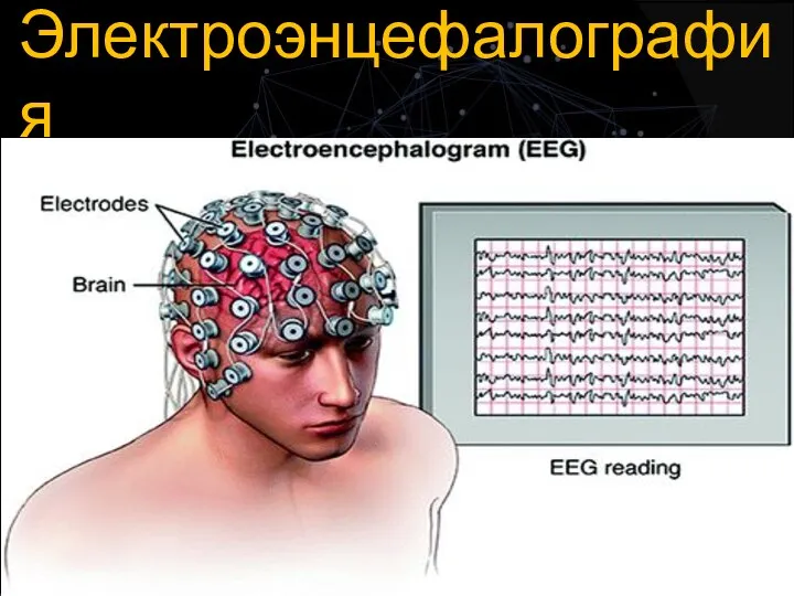 Электроэнцефалография