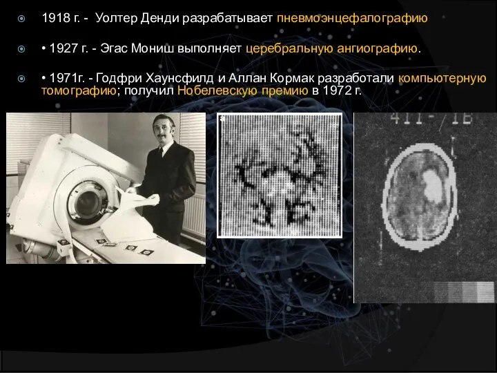 1918 г. - Уолтер Денди разрабатывает пневмоэнцефалографию • 1927 г. - Эгас