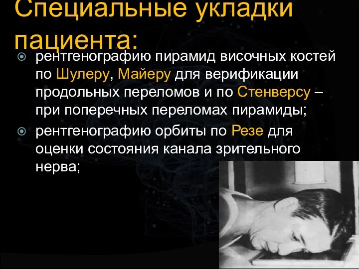 Специальные укладки пациента: рентгенографию пирамид височных костей по Шулеру, Майеру для верификации