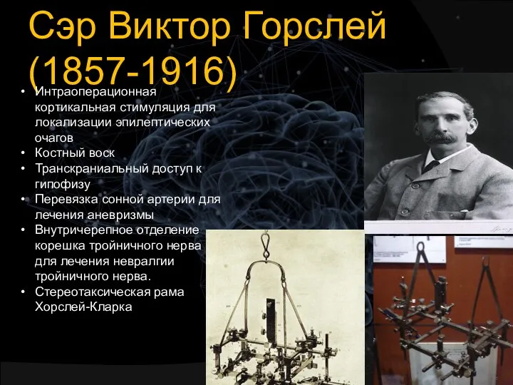 Сэр Виктор Горслей (1857-1916) Интраоперационная кортикальная стимуляция для локализации эпилептических очагов Костный