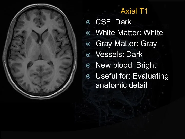 Axial T1 CSF: Dark White Matter: White Gray Matter: Gray Vessels: Dark