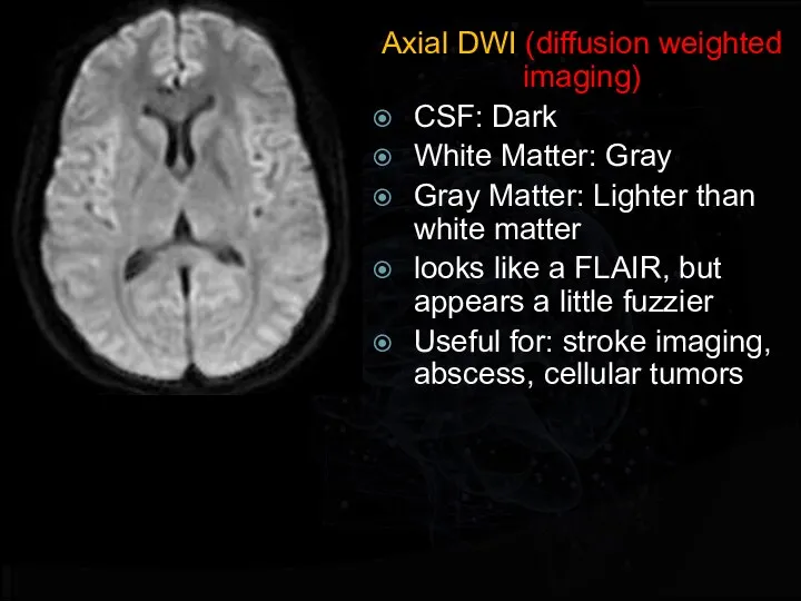 Axial DWI (diffusion weighted imaging) CSF: Dark White Matter: Gray Gray Matter: