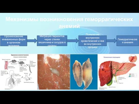 Механизмы возникновения геморрагических анемий Проникновение инвазионных форм в организм человека Миграция паразитов