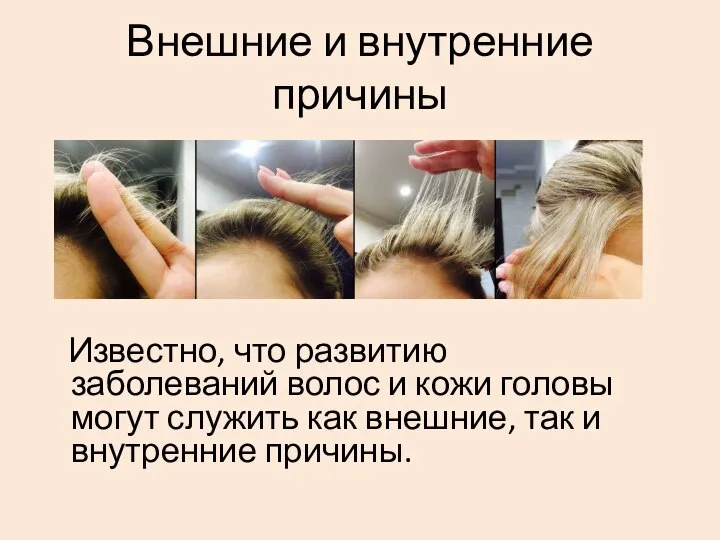 Внешние и внутренние причины Известно, что развитию заболеваний волос и кожи головы