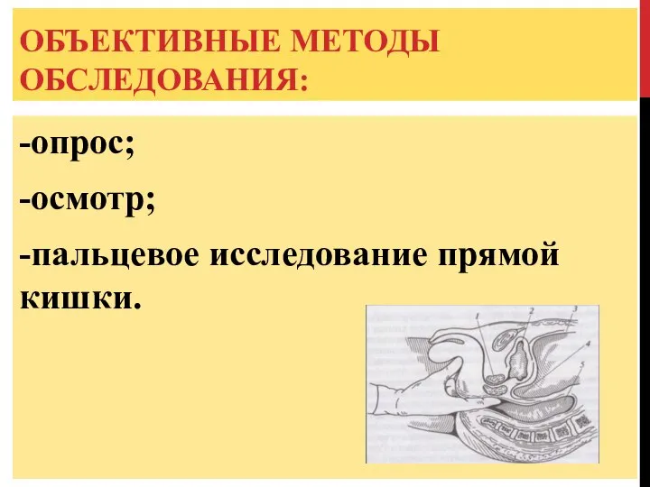 ОБЪЕКТИВНЫЕ МЕТОДЫ ОБСЛЕДОВАНИЯ: -опрос; -осмотр; -пальцевое исследование прямой кишки.