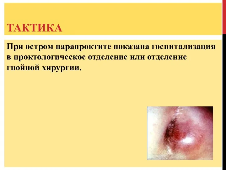 ТАКТИКА При остром парапроктите показана госпитализация в проктологическое отделение или отделение гнойной хирургии.