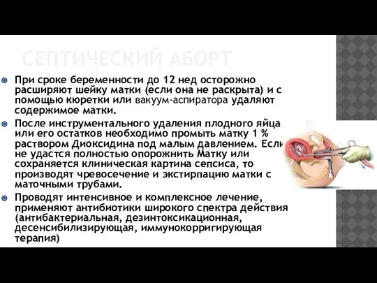 СЕПТИЧЕСКИЙ АБОРТ При сроке беременности до 12 нед осторожно расширяют шейку матки