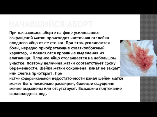 НАЧАВШИЙСЯ АБОРТ При начавшемся аборте на фоне усилившихся сокращений матки происходит частичная