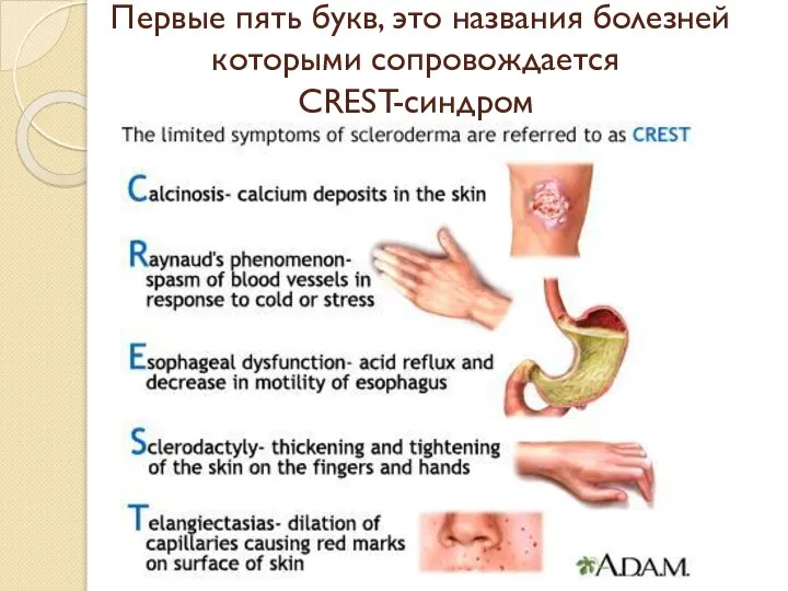 Первые пять букв, это названия болезней которыми сопровождается CREST-синдром