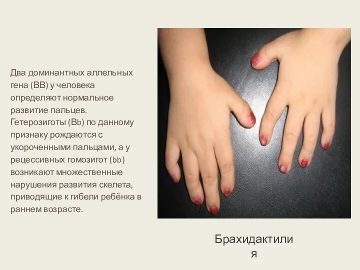 Два доминантных аллельных гена (ВВ) у человека определяют нормальное развитие пальцев. Гетерозиготы