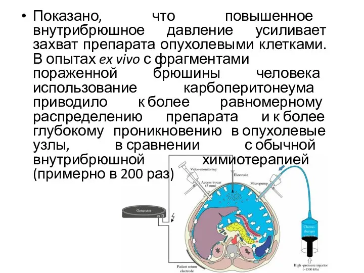 Показано, что повышенное внутрибрюшное давление усиливает захват препарата опухолевыми клетками. В опытах