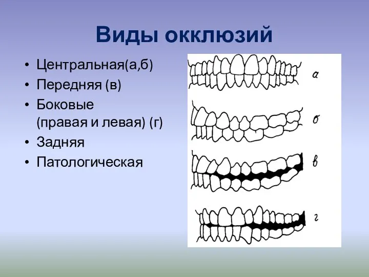 Виды окклюзий Центральная(а,б) Передняя (в) Боковые (правая и левая) (г) Задняя Патологическая