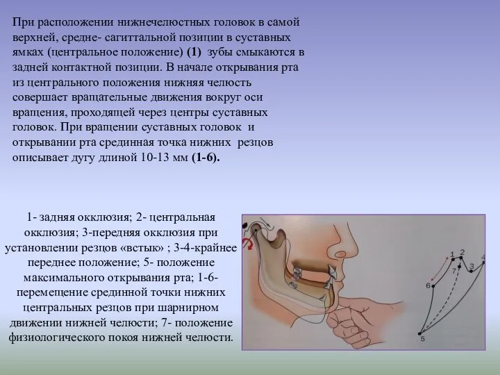 1- задняя окклюзия; 2- центральная окклюзия; 3-передняя окклюзия при установлении резцов «встык»