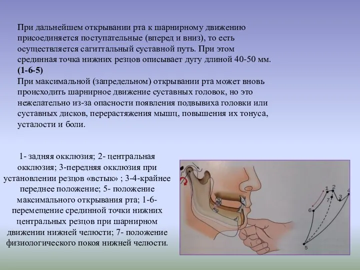 1- задняя окклюзия; 2- центральная окклюзия; 3-передняя окклюзия при установлении резцов «встык»