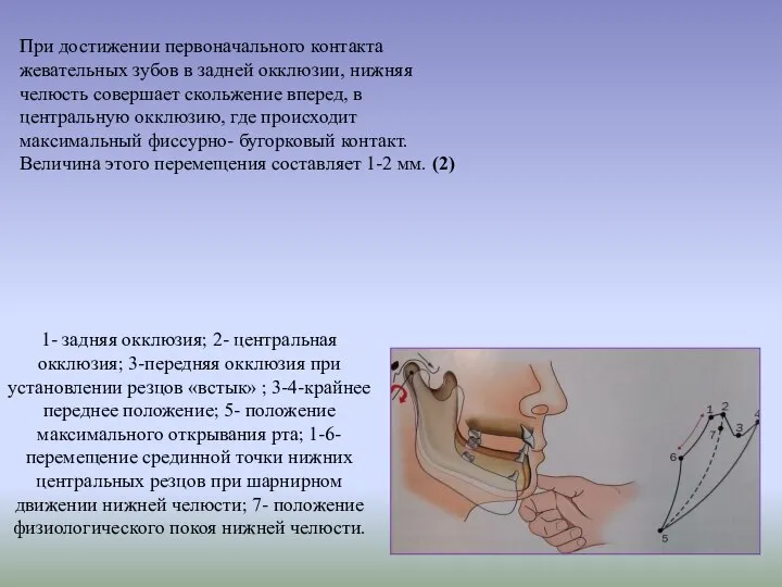 1- задняя окклюзия; 2- центральная окклюзия; 3-передняя окклюзия при установлении резцов «встык»