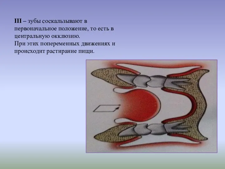 III – зубы соскальзывают в первоначальное положение, то есть в центральную окклюзию.