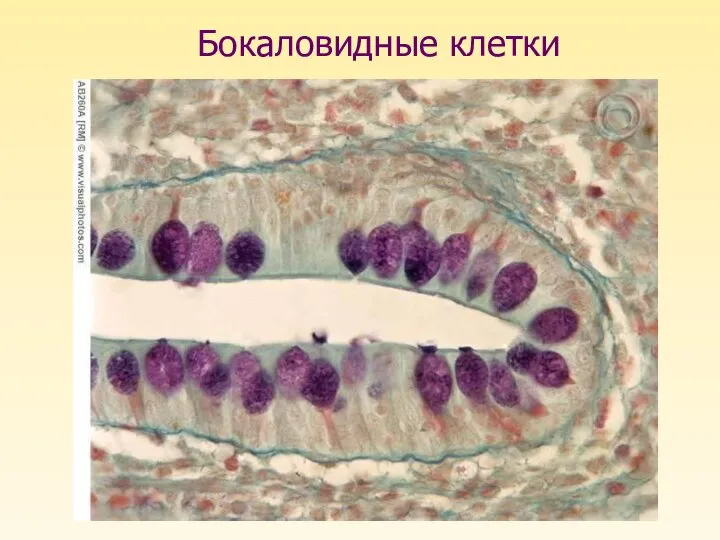 Бокаловидные клетки