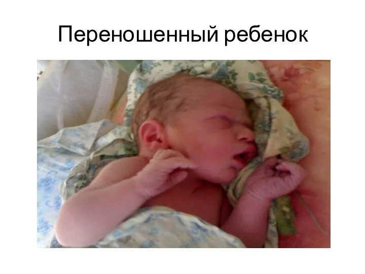 Переношенный ребенок