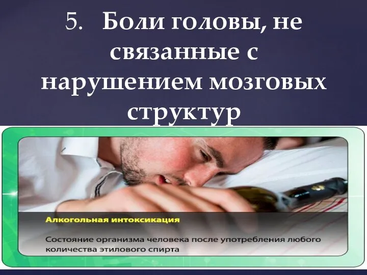 5. Боли головы, не связанные с нарушением мозговых структур