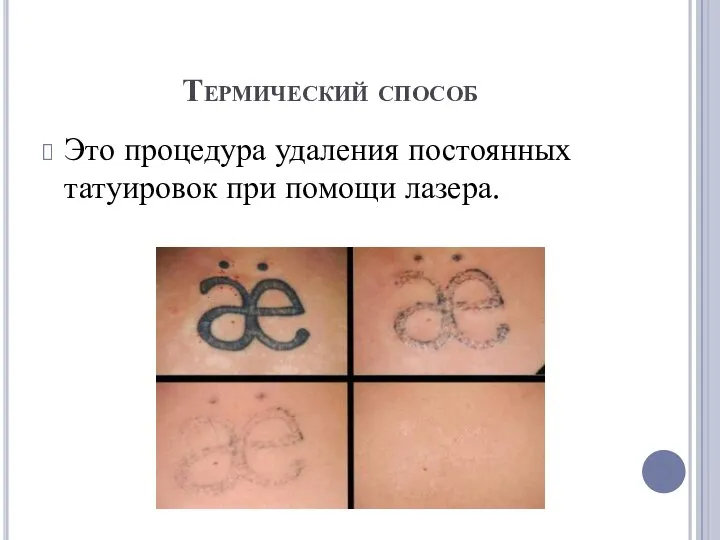 Термический способ Это процедура удаления постоянных татуировок при помощи лазера.