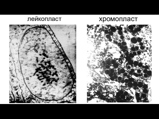 лейкопласт хромопласт