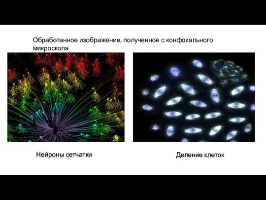 Деление клеток Нейроны сетчатки Обработанное изображение, полученное с конфокального микроскопа