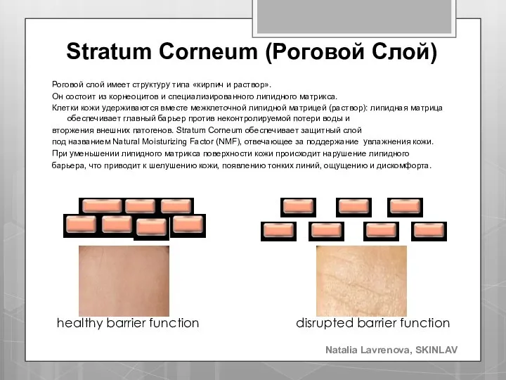 Stratum Corneum (Роговой Слой) Роговой слой имеет структуру типа «кирпич и раствор».