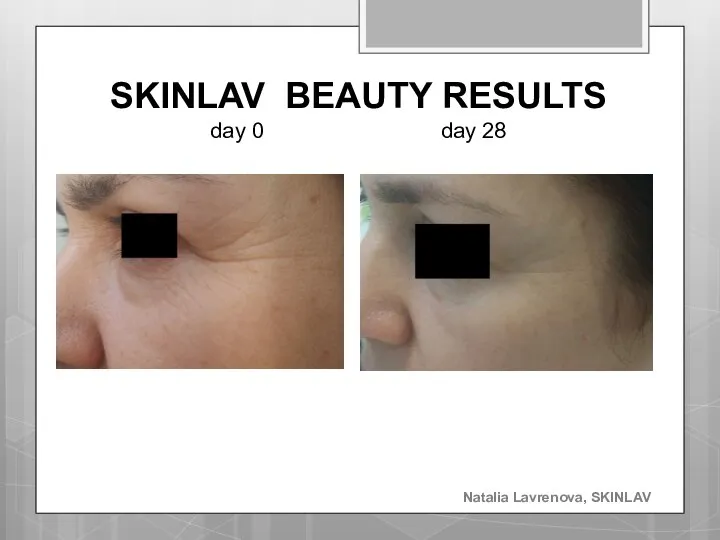 SKINLAV BEAUTY RESULTS day 0 day 28 Natalia Lavrenova, SKINLAV