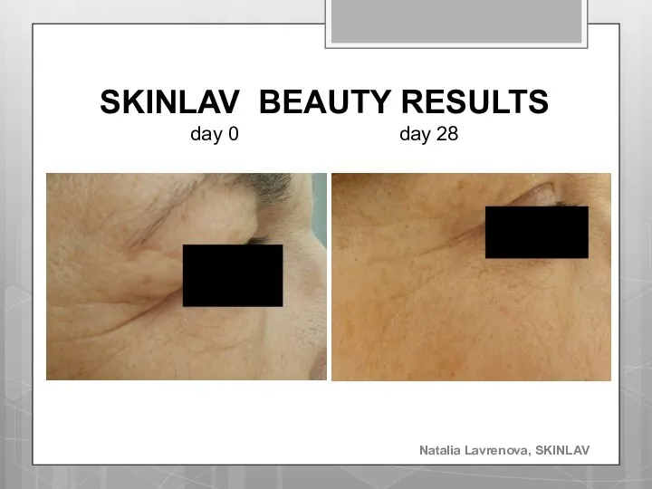 SKINLAV BEAUTY RESULTS day 0 day 28 Natalia Lavrenova, SKINLAV