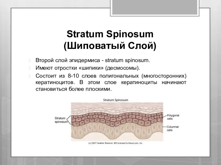Stratum Spinosum (Шиповатый Слой) Второй слой эпидермиса - stratum spinosum. Имеют отростки