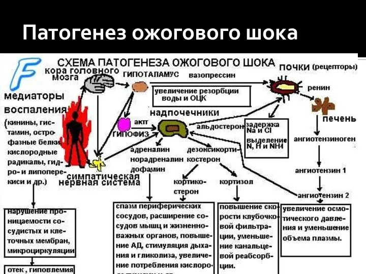 Патогенез ожоговой болезни схема