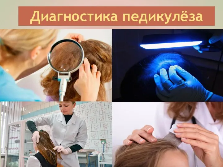 Диагностика педикулёза