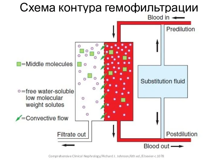 Схема контура гемофильтрации Comprehensive Clinical Nephrology/Richard J. Johnson/6th ed./Elsevier-c.1078