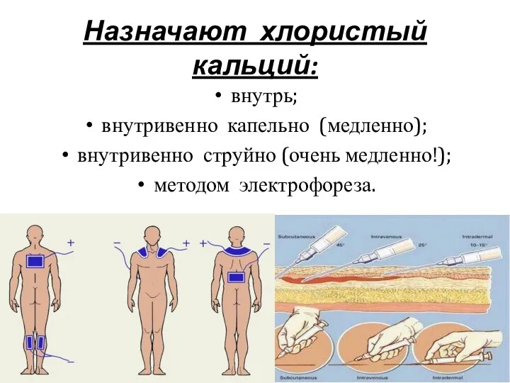 Назначают хлористый кальций: внутрь; внутривенно капельно (медленно); внутривенно струйно (очень медленно!); методом электрофореза.