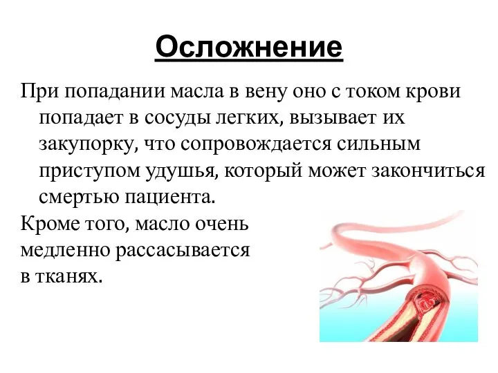 Осложнение При попадании масла в вену оно с током крови попадает в