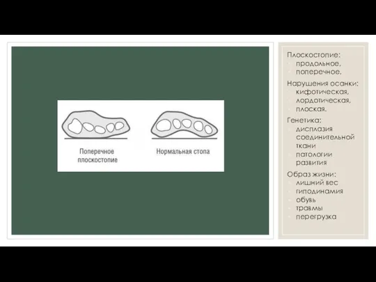 Плоскостопие: продольное, поперечное. Нарушения осанки: кифотическая, лордотическая, плоская. Генетика: дисплазия соединительной ткани