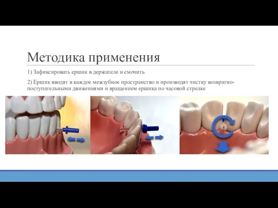 Методика применения 1) Зафиксировать ершик в держателе и смочить 2) Ершик вводят