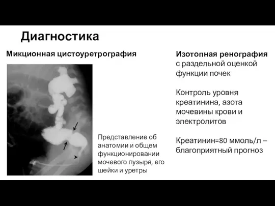 Диагностика Микционная цистоуретрография Представление об анатомии и общем функционировании мочевого пузыря, его