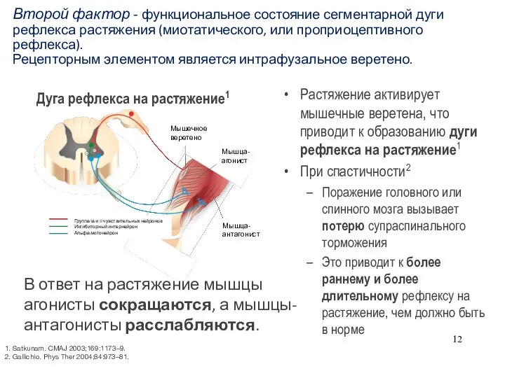 Дуга рефлекса на растяжение1 1. Satkunam. CMAJ 2003;169:1173–9. 2. Gallichio. Phys Ther