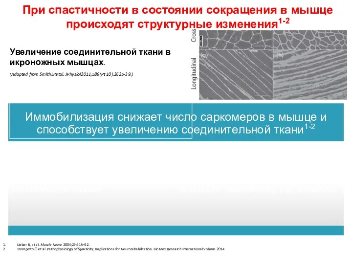 Lieber R, et al. Muscle Nerve 2004;29:615–62. Trompetto С et al. Pathophysiology