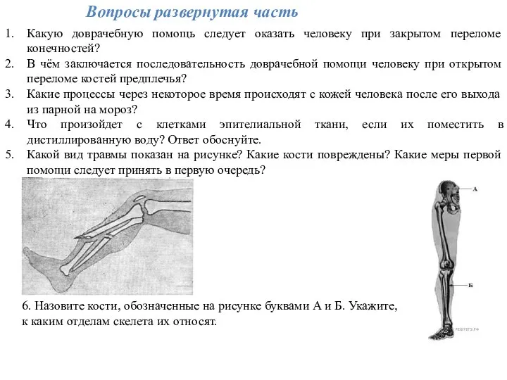 Вопросы развернутая часть Какую доврачебную помощь следует оказать человеку при закрытом переломе