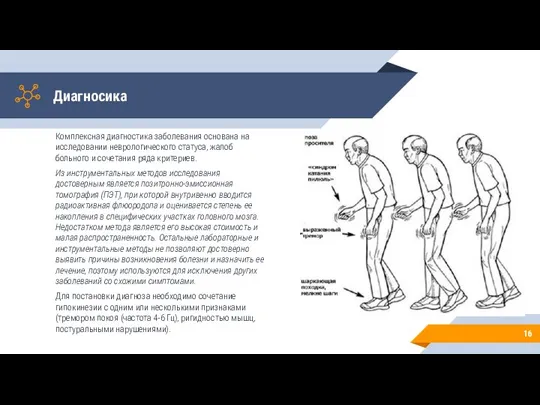 Диагносика Комплексная диагностика заболевания основана на исследовании неврологического статуса, жалоб больного и