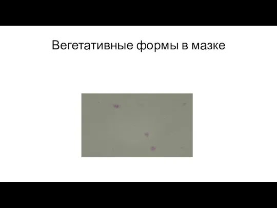 Вегетативные формы в мазке